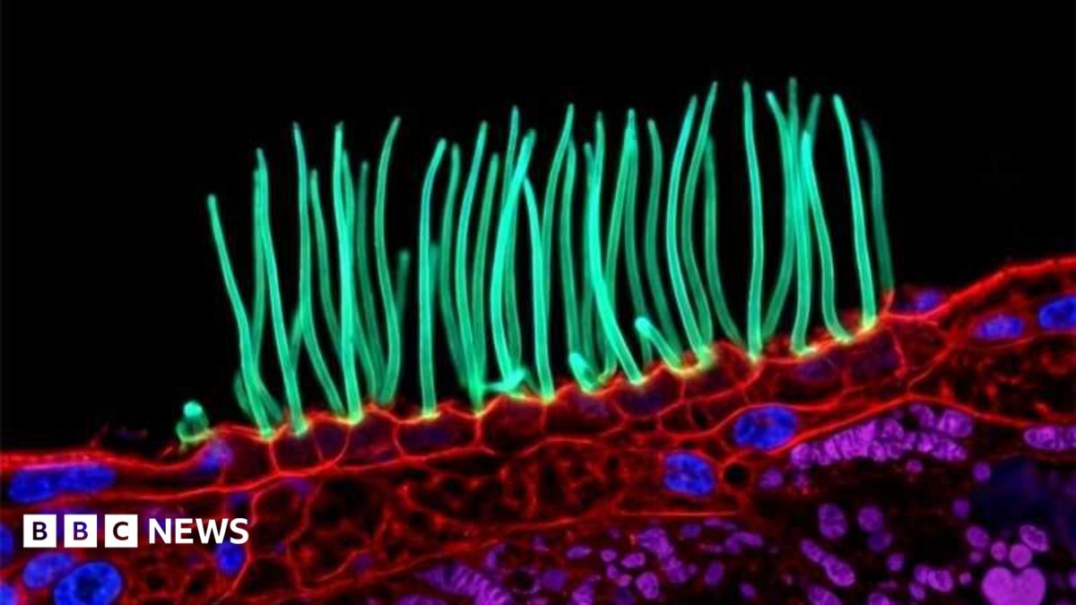 Nikon Photomicrography Controversy Sparks Global Debate on Scientific Integrity